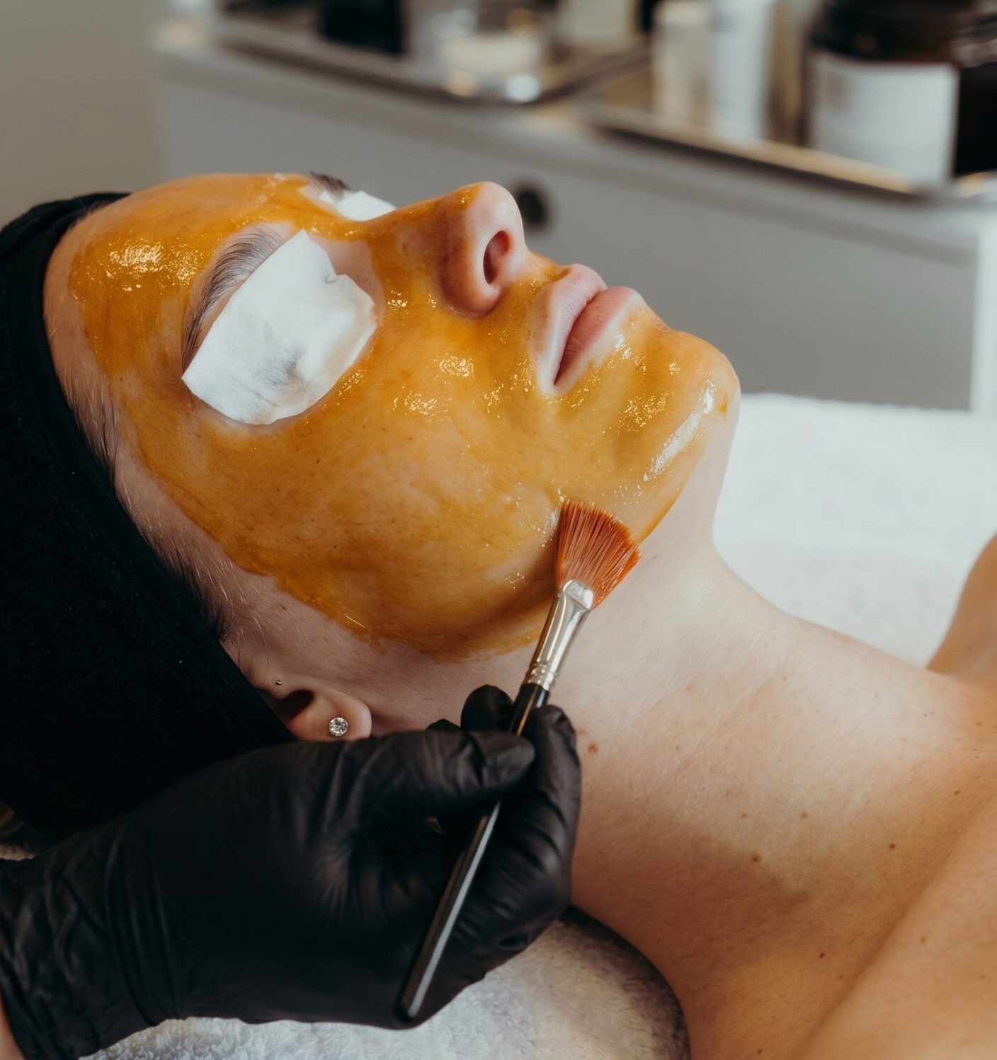Professional chemical peel treatment for fading dark spots